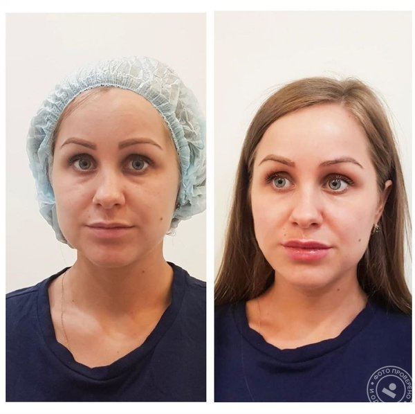 Клиника IHC Clinic cosmetology & hair на метро Кропоткинская - фото 5