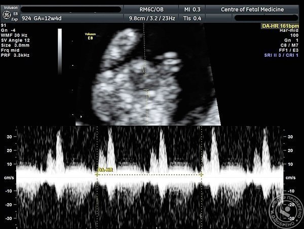 Центр медицины плода «МЕДИКА» Васильевского острова - фото 6