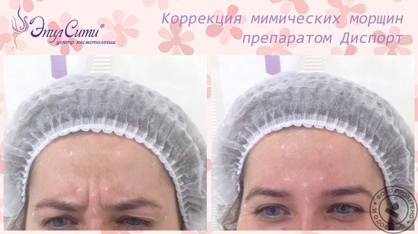 Центр косметологии «ЭпилСити» на Киевской - фото 2